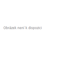 Cibule restovaná 500g ESSA (1)